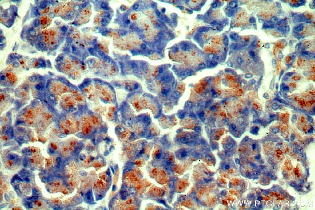 Immunohistochemistry (IHC) staining of human pancreas tissue using CTRL Polyclonal antibody (14856-1-AP)