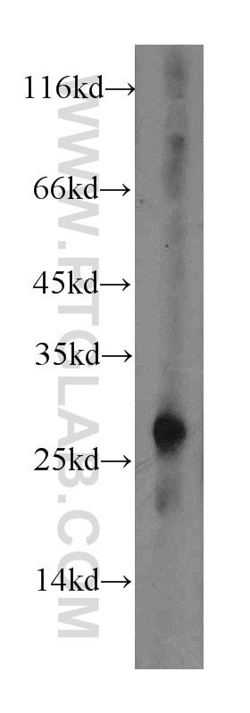 Western Blot (WB) analysis of BxPC-3 cells using CTRL Polyclonal antibody (14856-1-AP)
