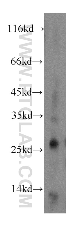 Western Blot (WB) analysis of mouse pancreas tissue using CTRL Polyclonal antibody (14856-1-AP)