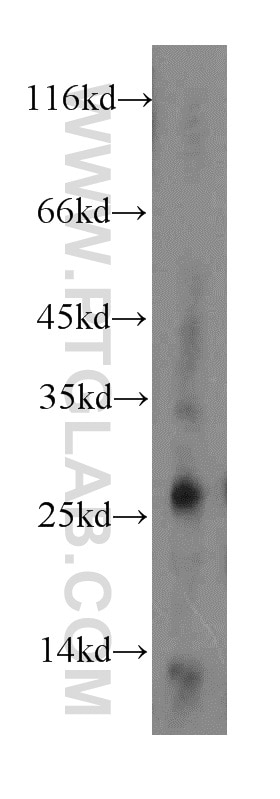 WB analysis of mouse pancreas using 14856-1-AP