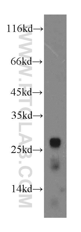 Western Blot (WB) analysis of mouse pancreas tissue using CTRL Polyclonal antibody (14856-1-AP)