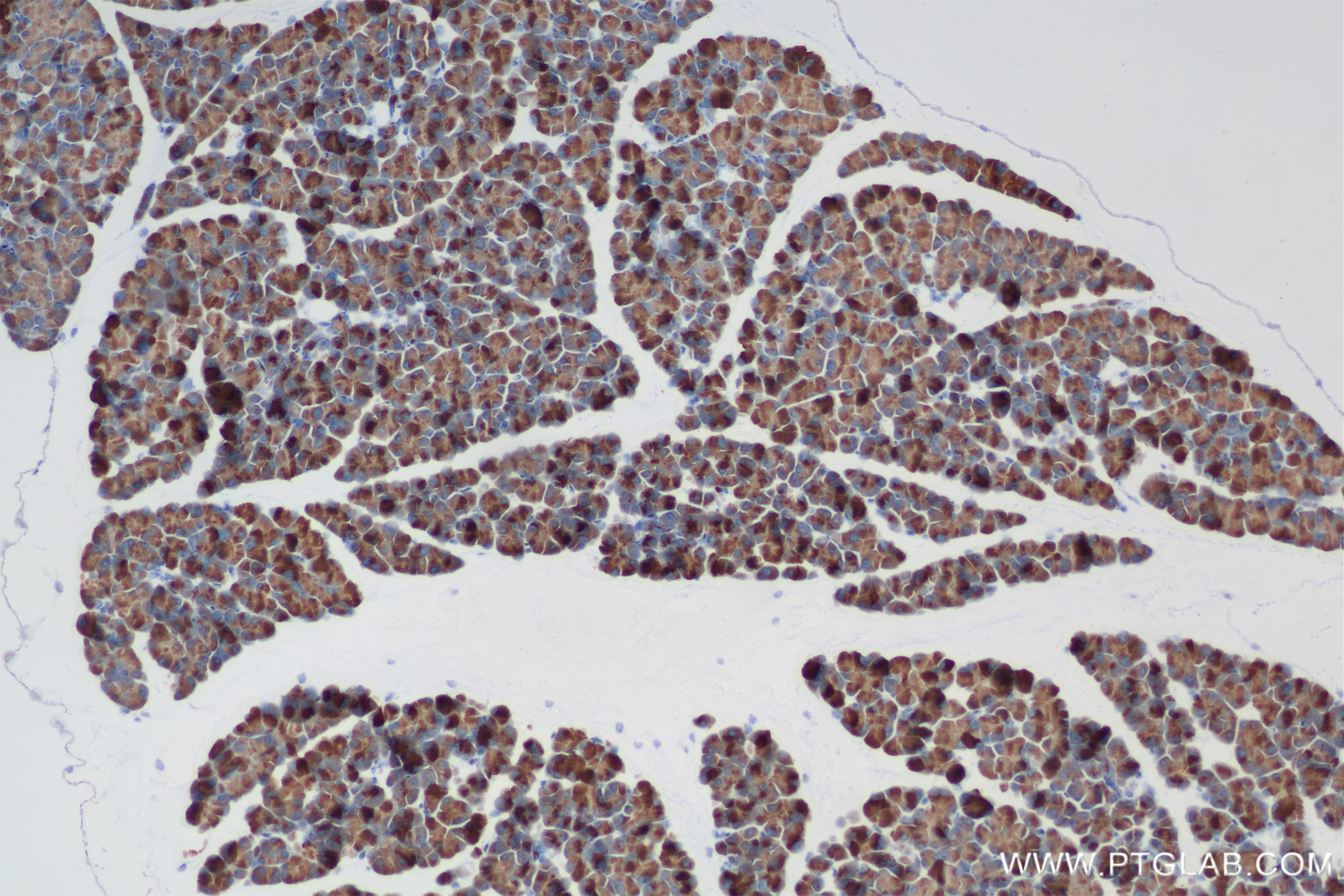 Immunohistochemistry (IHC) staining of mouse pancreas tissue using CTRL Recombinant antibody (84572-4-RR)