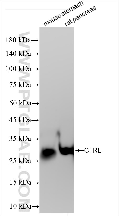 Western Blot (WB) analysis of various lysates using CTRL Recombinant antibody (84572-4-RR)