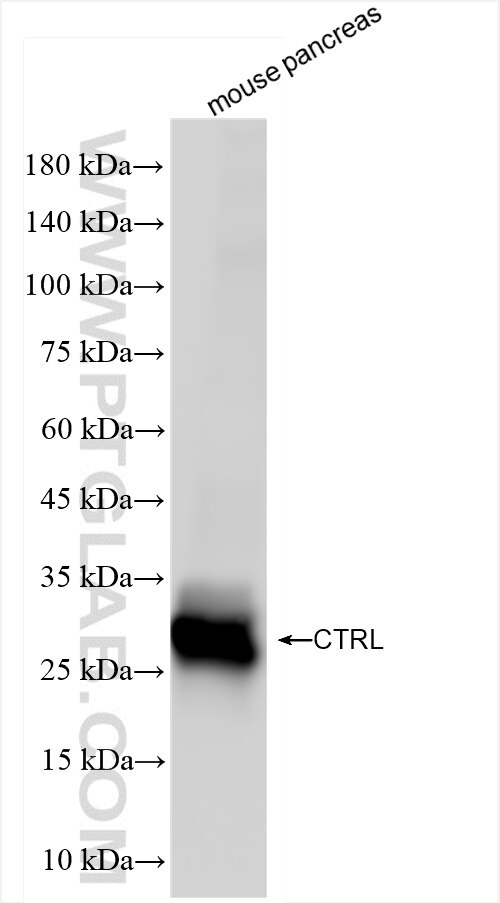 Western Blot (WB) analysis of mouse pancreas tissue using CTRL Recombinant antibody (84572-4-RR)