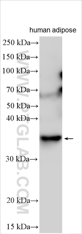 CTRP1