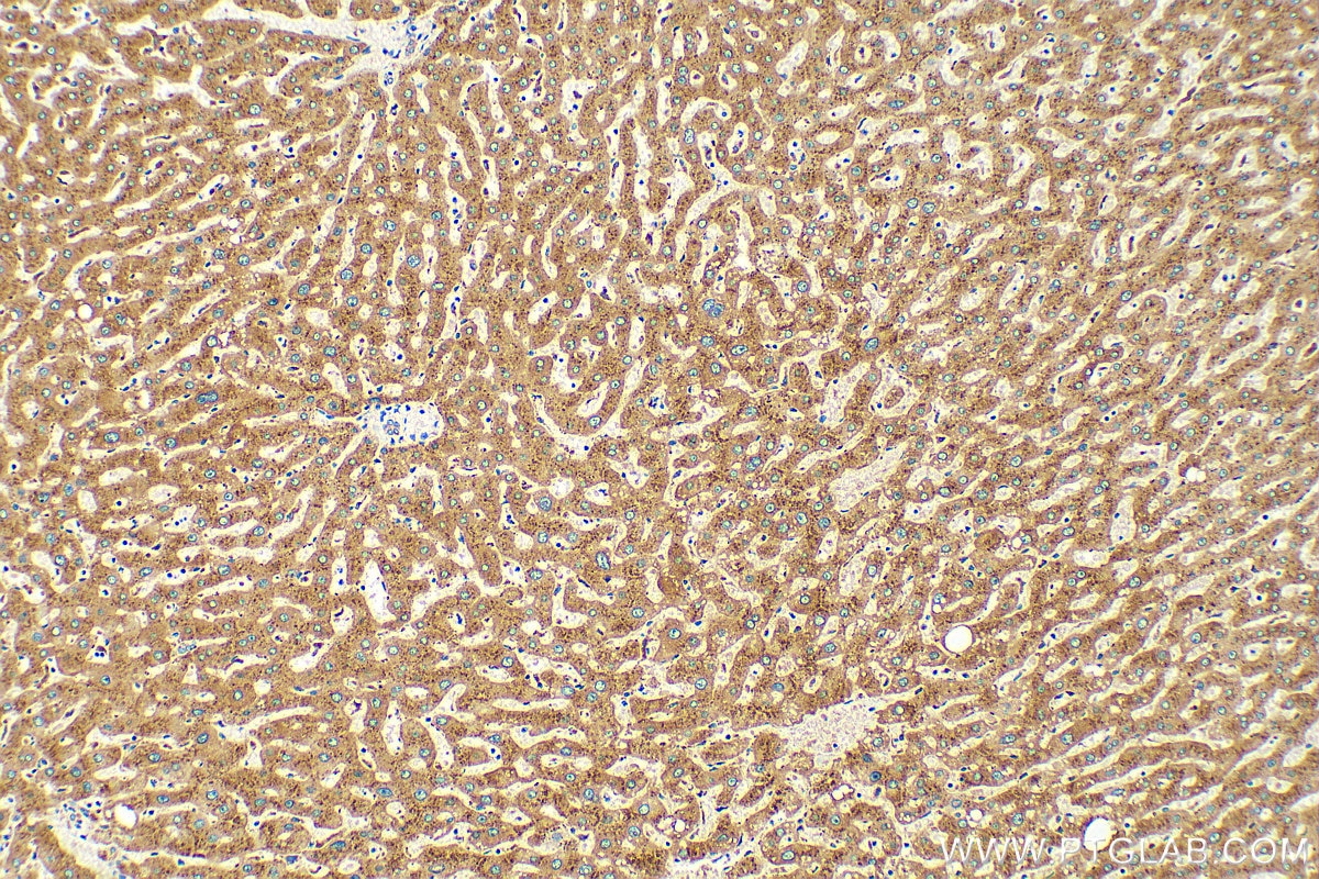 Immunohistochemistry (IHC) staining of human liver tissue using Cathepsin A Polyclonal antibody (15020-1-AP)