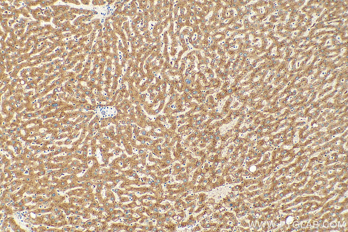 IHC staining of human liver using 15020-1-AP