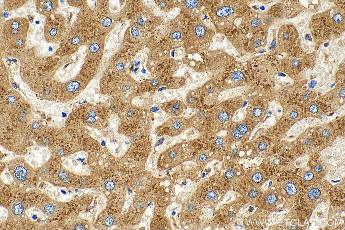 Immunohistochemistry (IHC) staining of human liver tissue using Cathepsin A Polyclonal antibody (15020-1-AP)