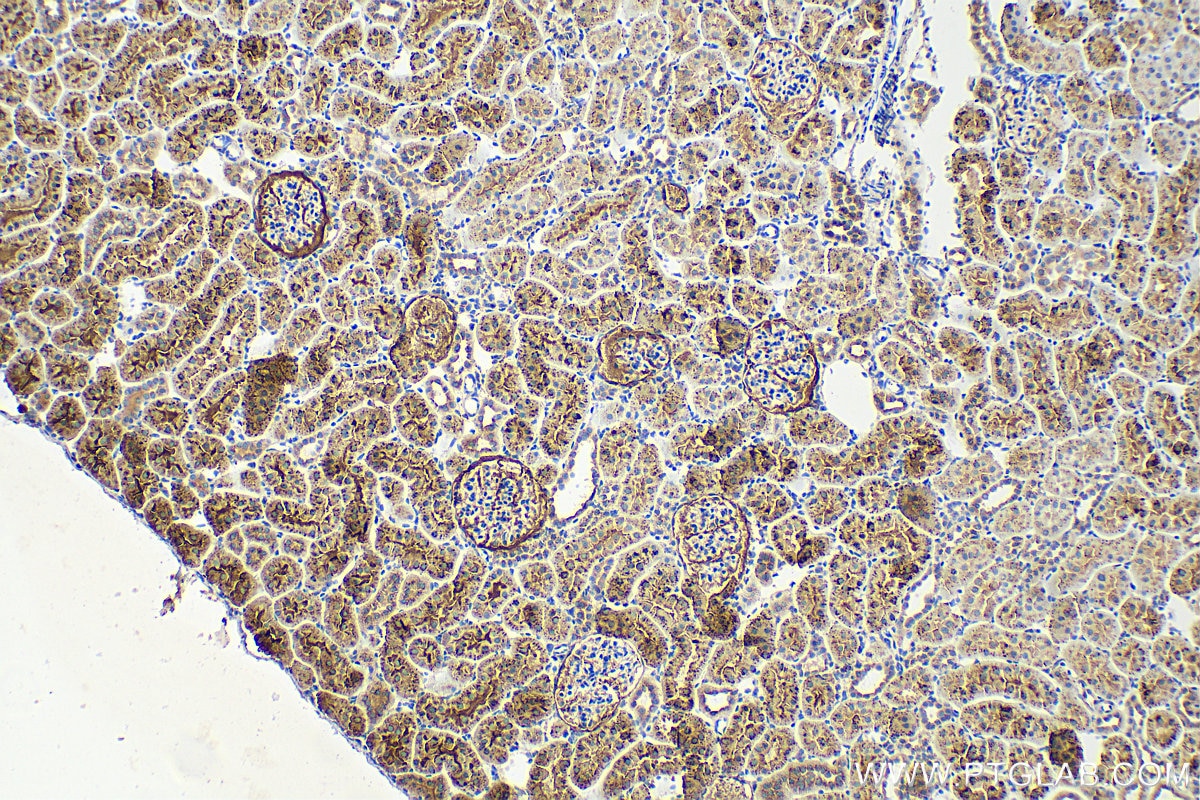 Immunohistochemistry (IHC) staining of rat kidney tissue using Cathepsin A Polyclonal antibody (15020-1-AP)