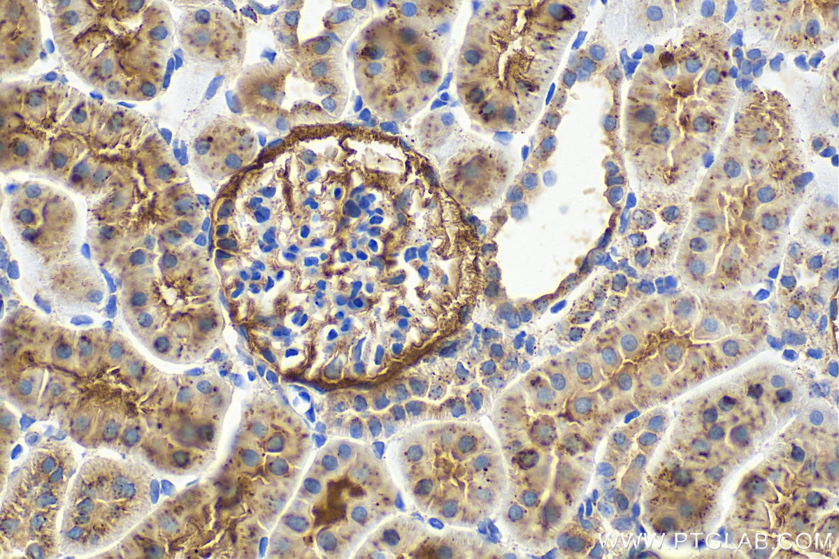 Immunohistochemistry (IHC) staining of rat kidney tissue using Cathepsin A Polyclonal antibody (15020-1-AP)