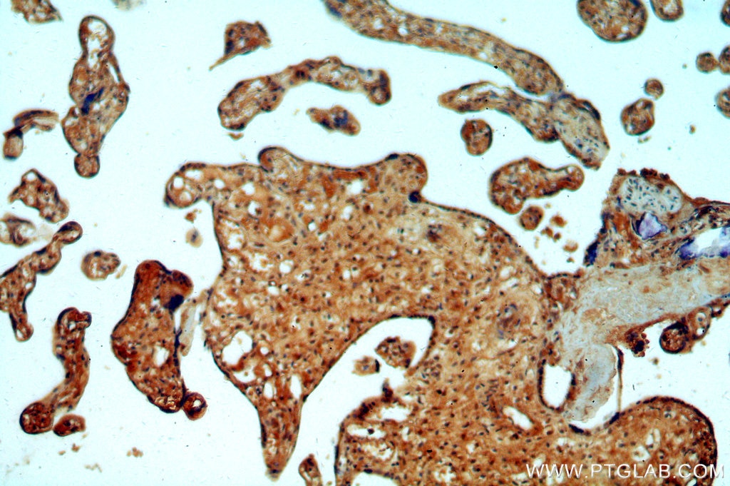 Cathepsin A