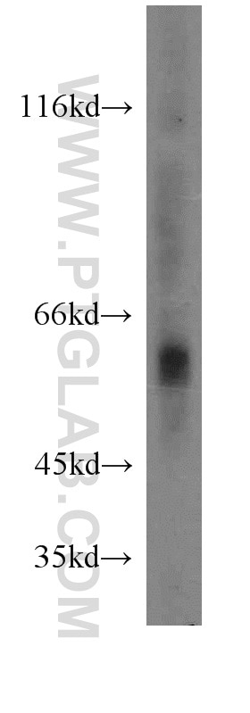 Western Blot (WB) analysis of Sp2/0 cells using Cathepsin A Polyclonal antibody (15020-1-AP)