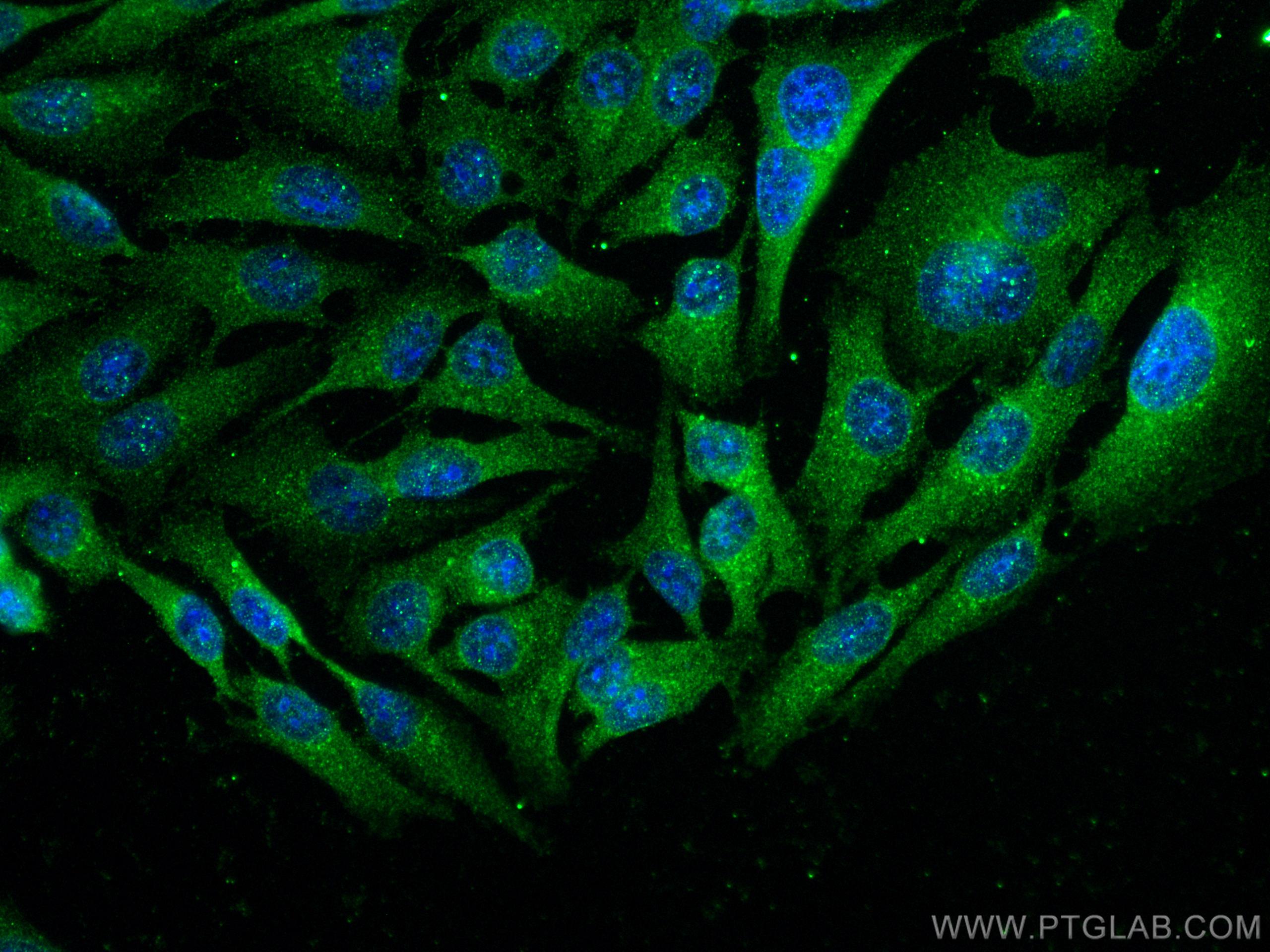 Immunofluorescence (IF) / fluorescent staining of A375 cells using Cathepsin B Polyclonal antibody (12216-1-AP)