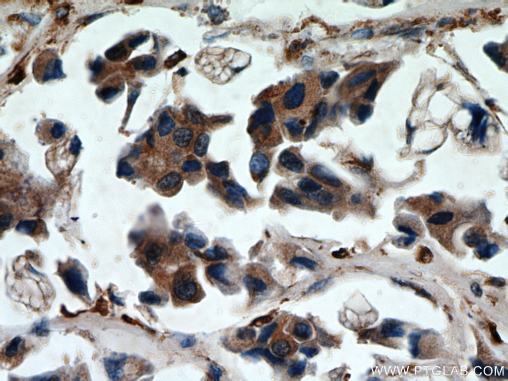 Cathepsin B Polyclonal antibody