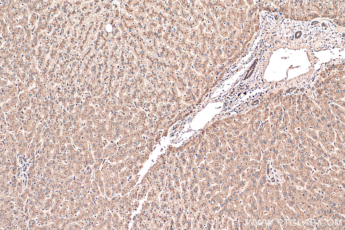 IHC staining of human liver using 55021-1-AP