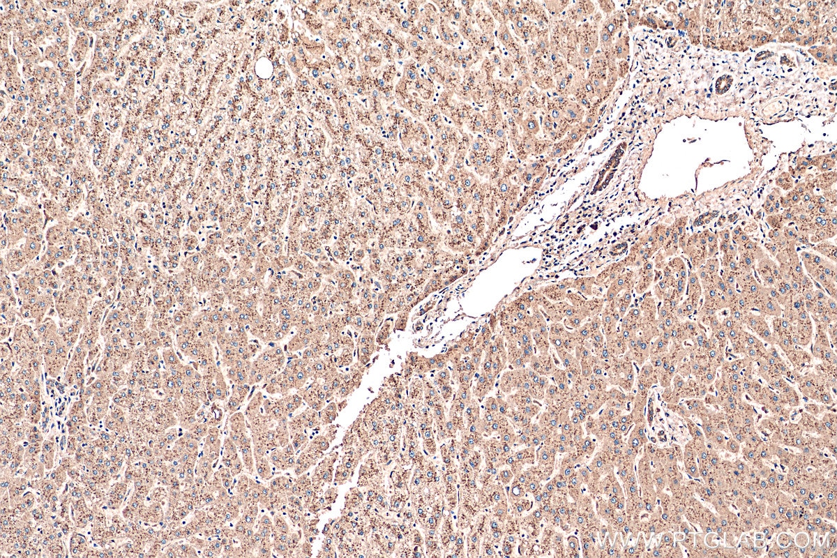 Immunohistochemistry (IHC) staining of human liver tissue using Cathepsin D Polyclonal antibody (55021-1-AP)