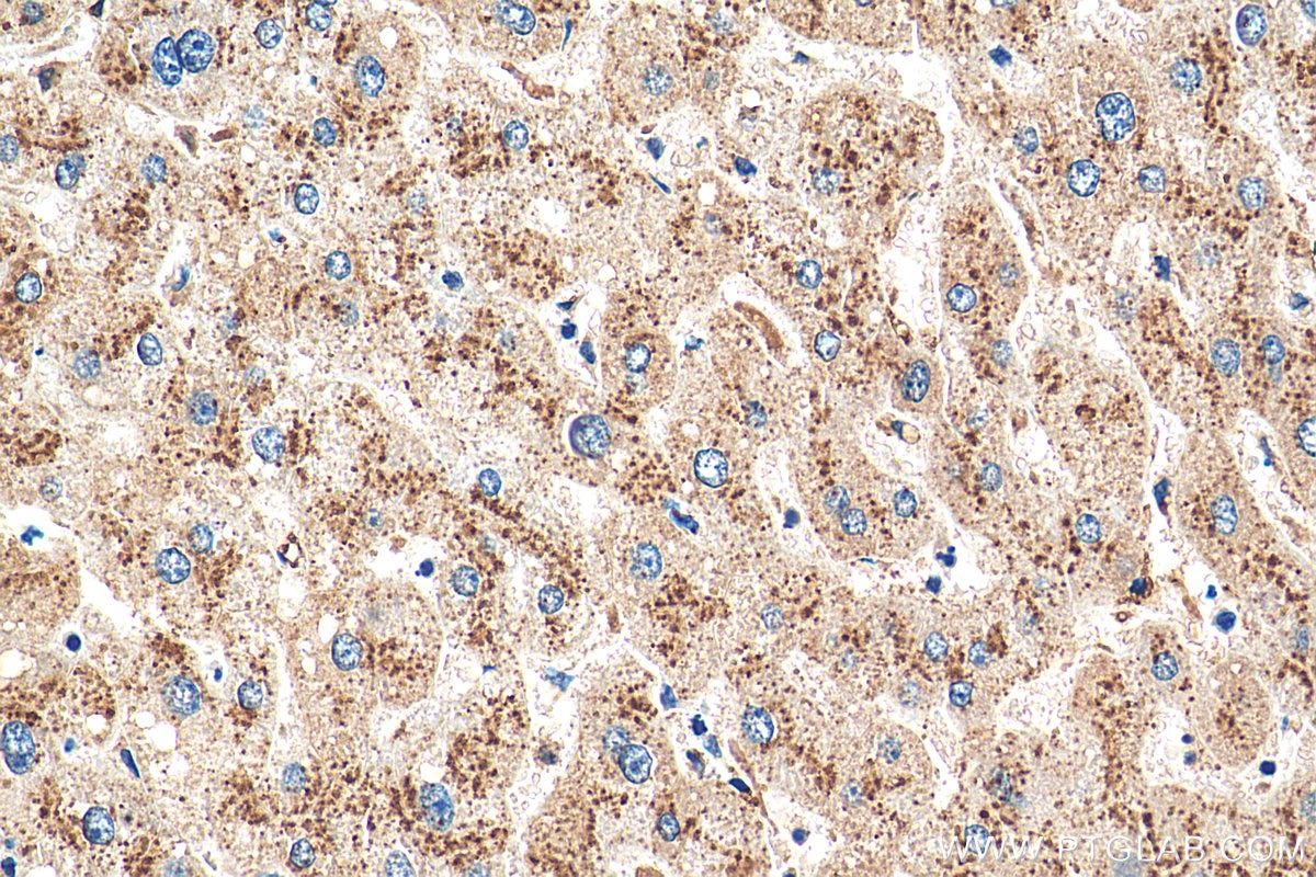 IHC staining of human liver using 55021-1-AP