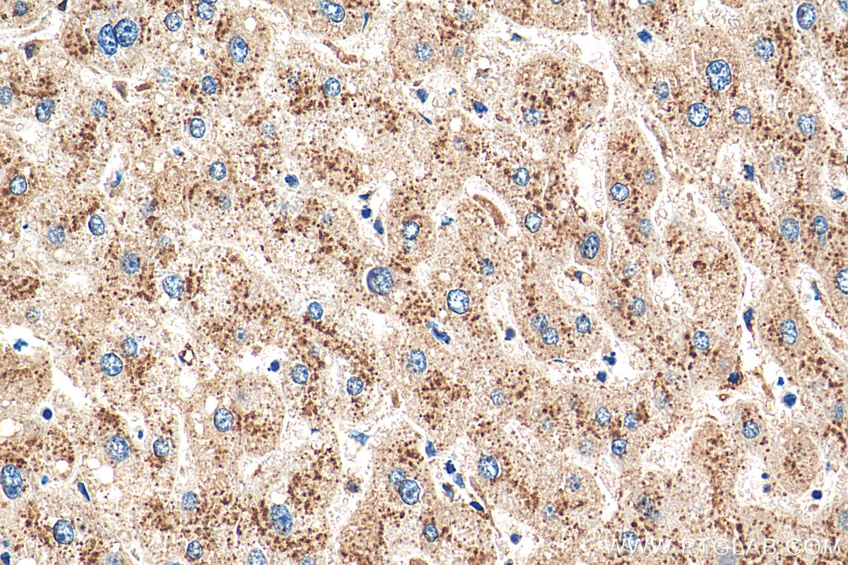 Immunohistochemistry (IHC) staining of human liver tissue using Cathepsin D Polyclonal antibody (55021-1-AP)