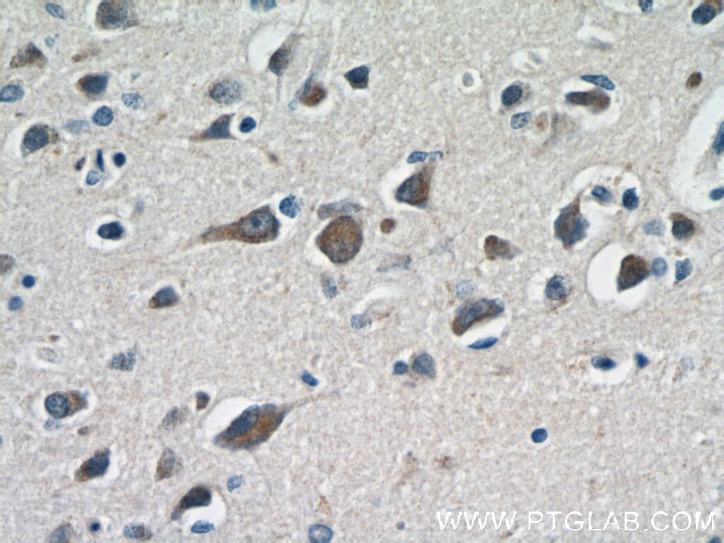 Cathepsin D Polyclonal antibody