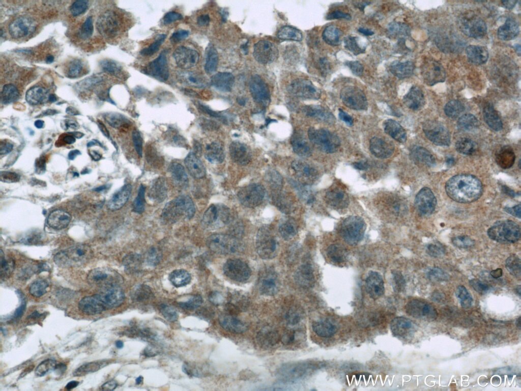 Cathepsin D Polyclonal antibody