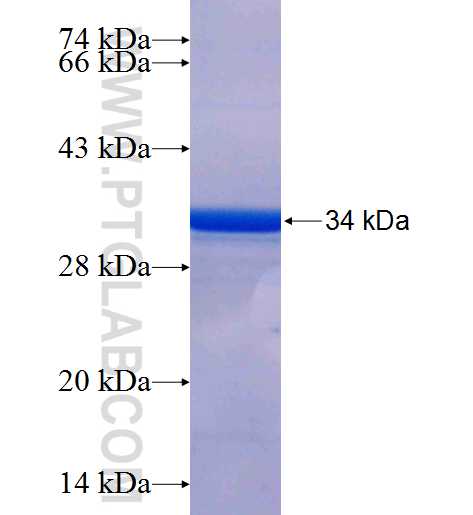 CTSE fusion protein Ag25936 SDS-PAGE