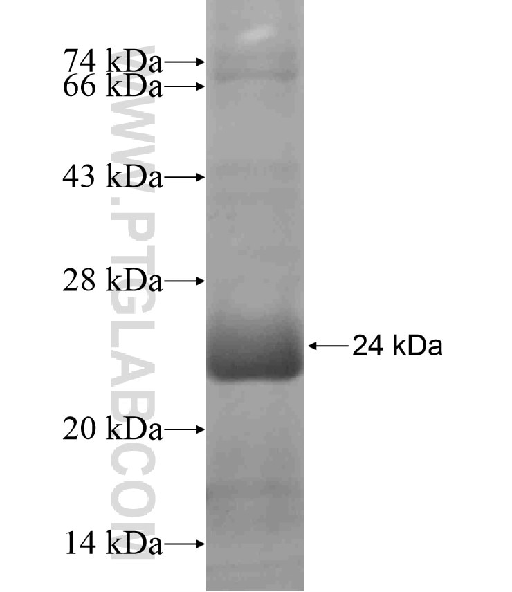 CTSE fusion protein Ag18164 SDS-PAGE