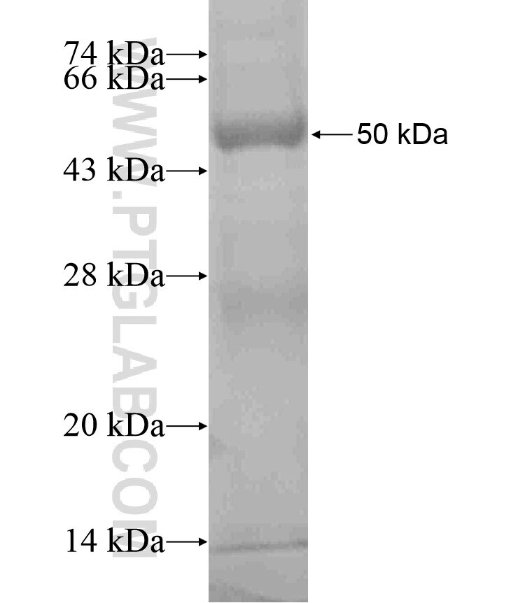 CTSE fusion protein Ag18484 SDS-PAGE