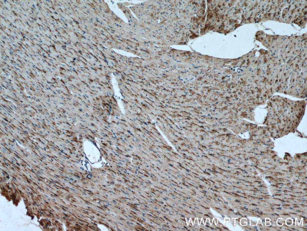 Immunohistochemistry (IHC) staining of mouse heart tissue using Cathepsin F Polyclonal antibody (11055-1-AP)