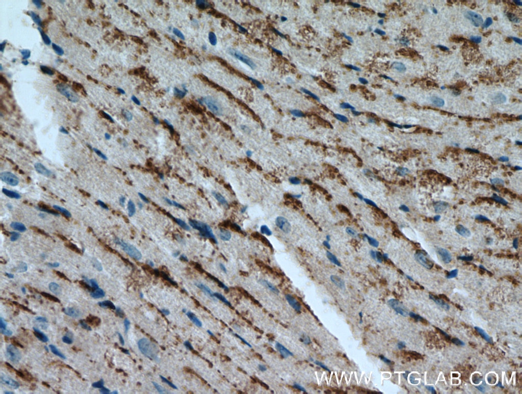 Immunohistochemistry (IHC) staining of mouse heart tissue using Cathepsin F Polyclonal antibody (11055-1-AP)