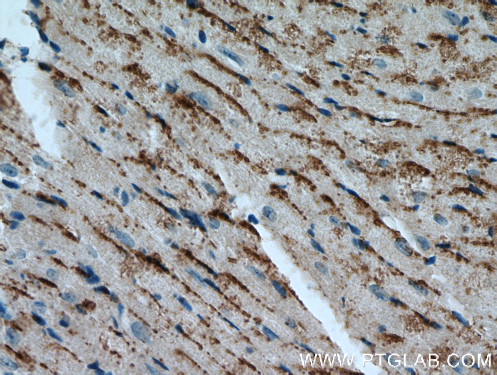 Immunohistochemistry (IHC) staining of mouse heart tissue using Cathepsin F Polyclonal antibody (11055-1-AP)