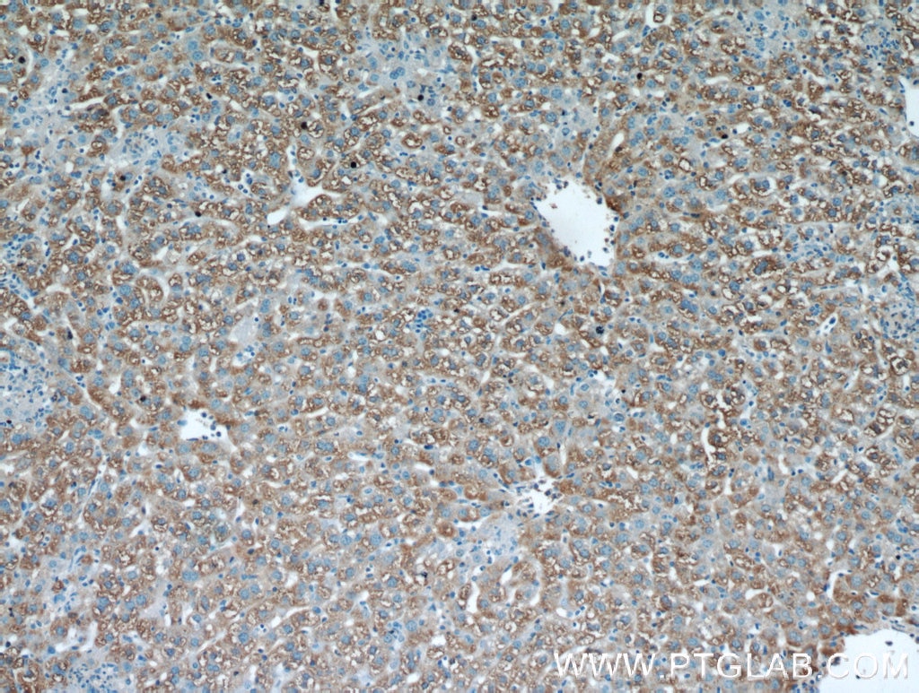 IHC staining of mouse liver using 11055-1-AP