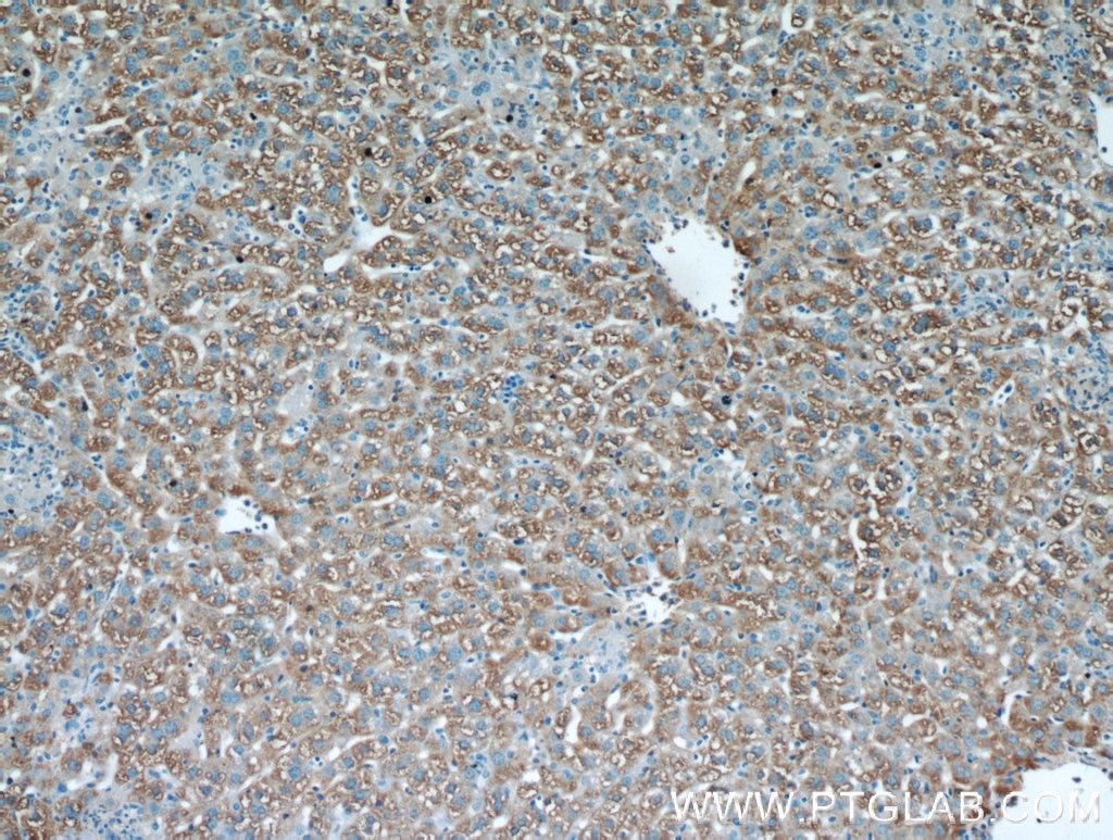 Immunohistochemistry (IHC) staining of mouse liver tissue using Cathepsin F Polyclonal antibody (11055-1-AP)