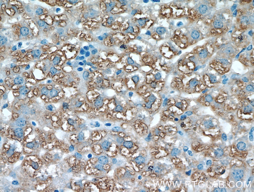 Immunohistochemistry (IHC) staining of mouse liver tissue using Cathepsin F Polyclonal antibody (11055-1-AP)