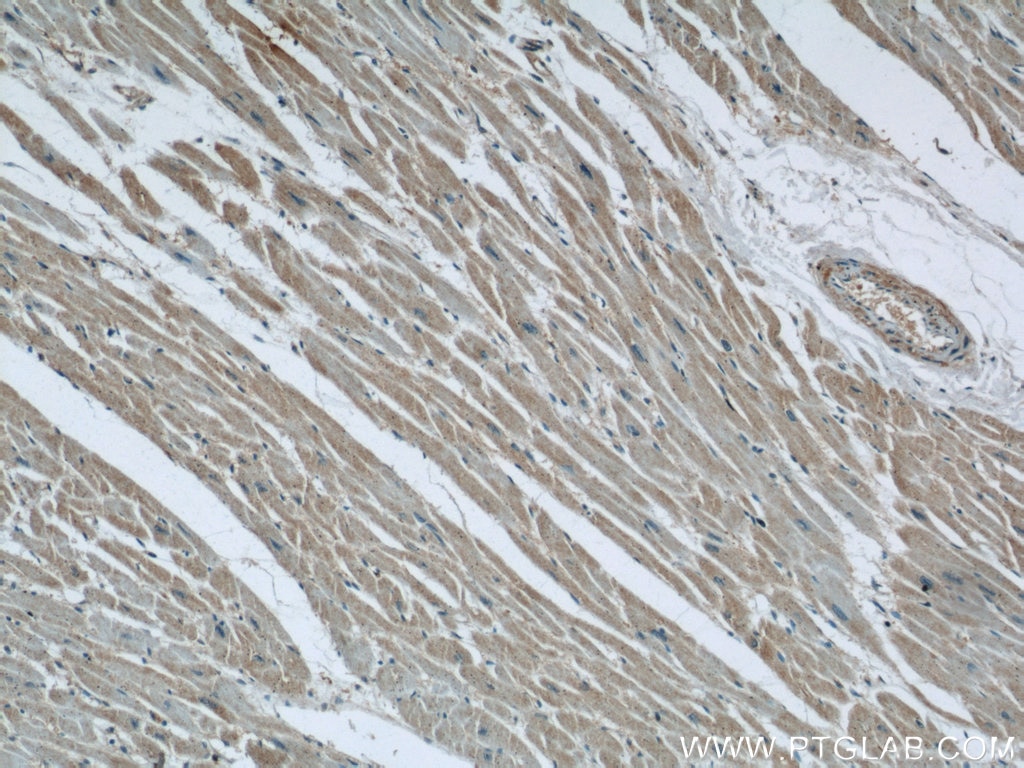 Immunohistochemistry (IHC) staining of human heart tissue using Cathepsin F Polyclonal antibody (11055-1-AP)