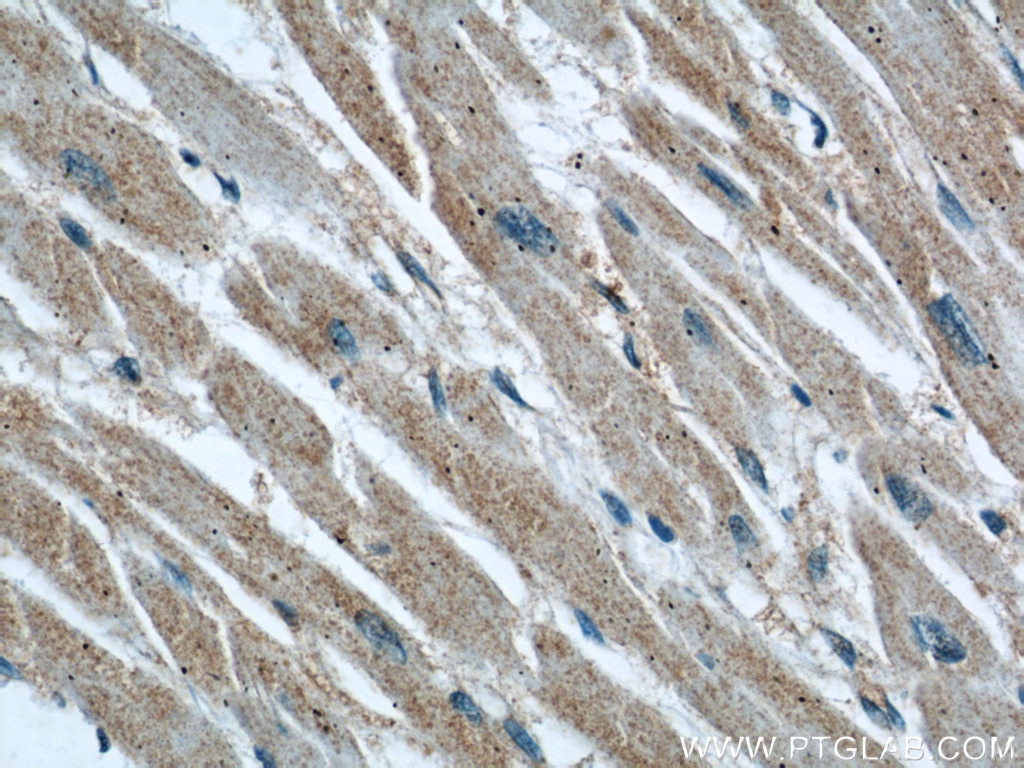 Immunohistochemistry (IHC) staining of human heart tissue using Cathepsin F Polyclonal antibody (11055-1-AP)