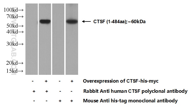 Cathepsin F