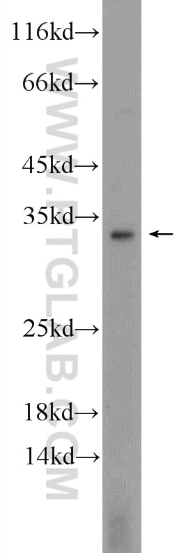Western Blot (WB) analysis of MCF-7 cells using Cathepsin G Polyclonal antibody (23840-1-AP)