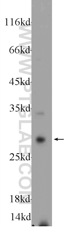 Western Blot (WB) analysis of MDA-MB-453s cells using Cathepsin G Polyclonal antibody (23840-1-AP)