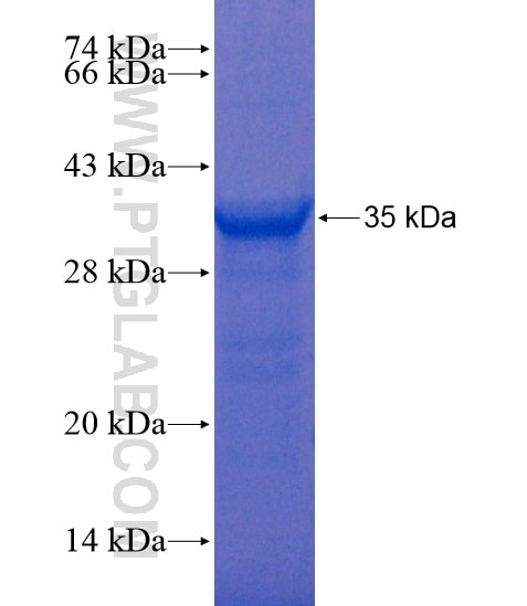 CTSG fusion protein Ag20818 SDS-PAGE