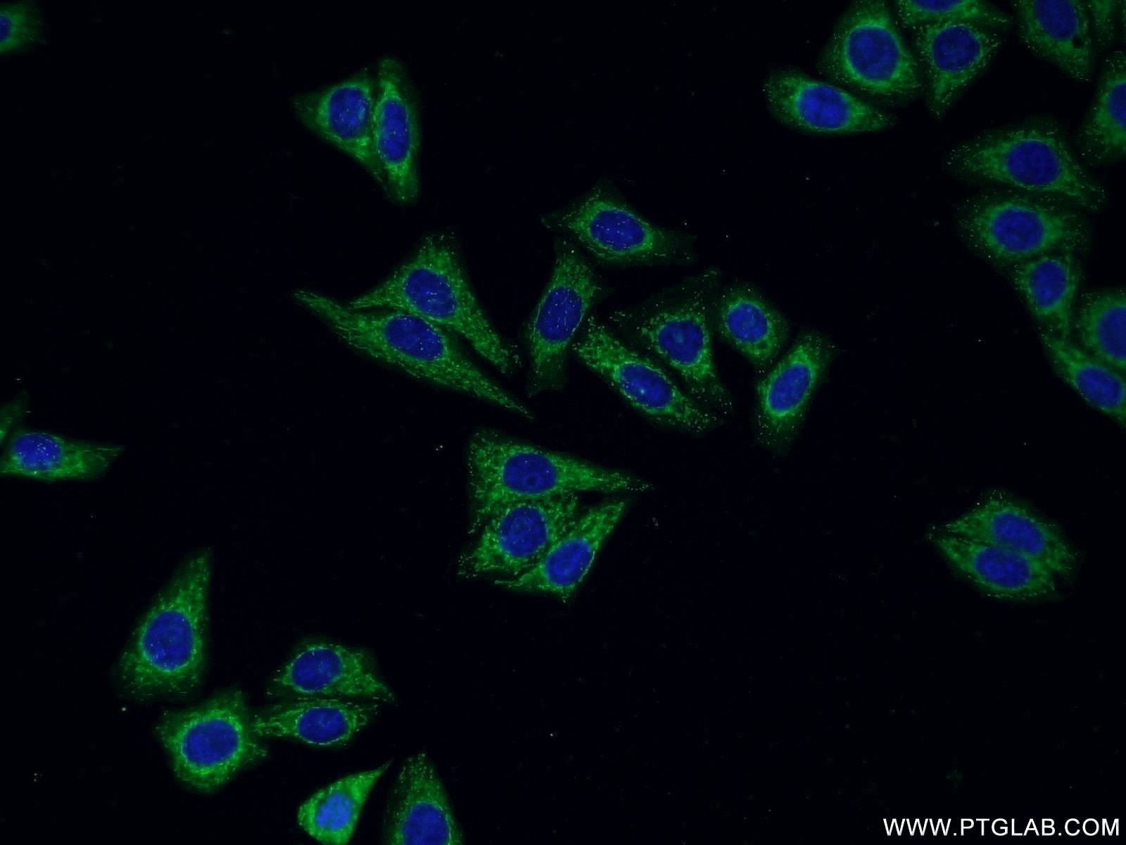 Cathepsin H