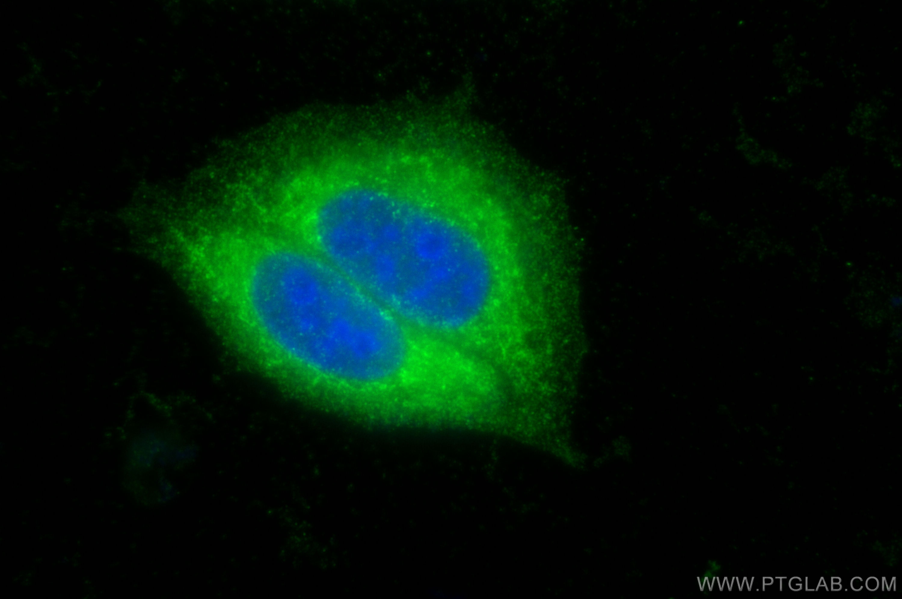 Immunofluorescence (IF) / fluorescent staining of HepG2 cells using Cathepsin H Polyclonal antibody (10315-1-AP)