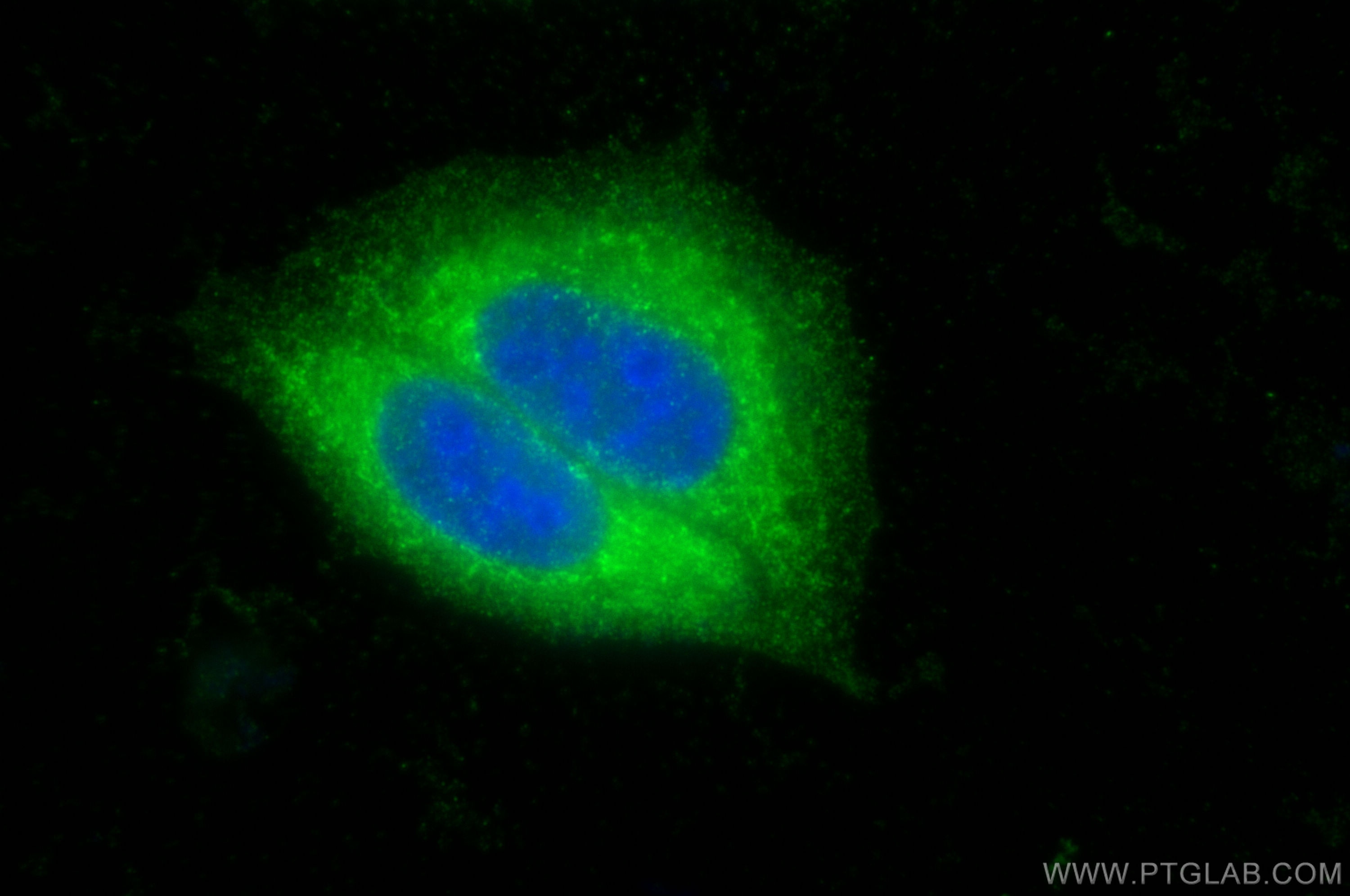 IF Staining of HepG2 using 10315-1-AP