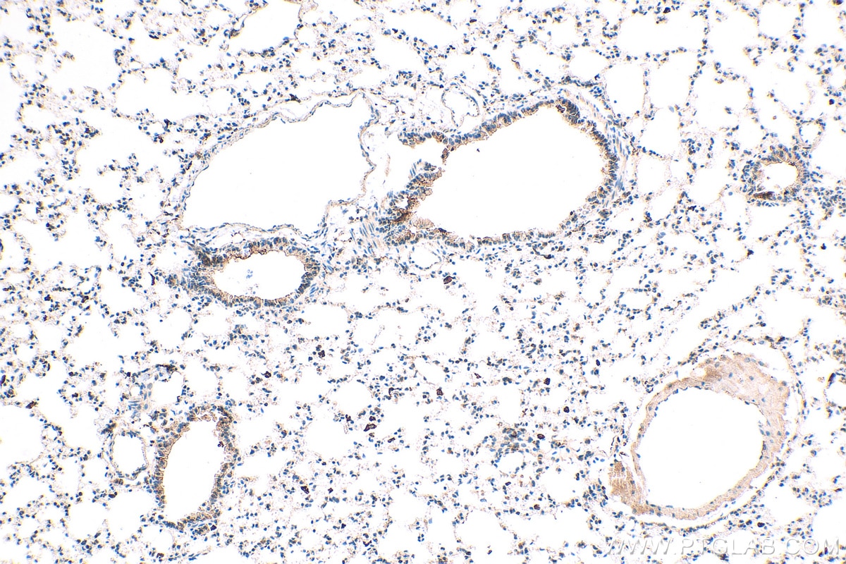 IHC staining of mouse lung using 10315-1-AP