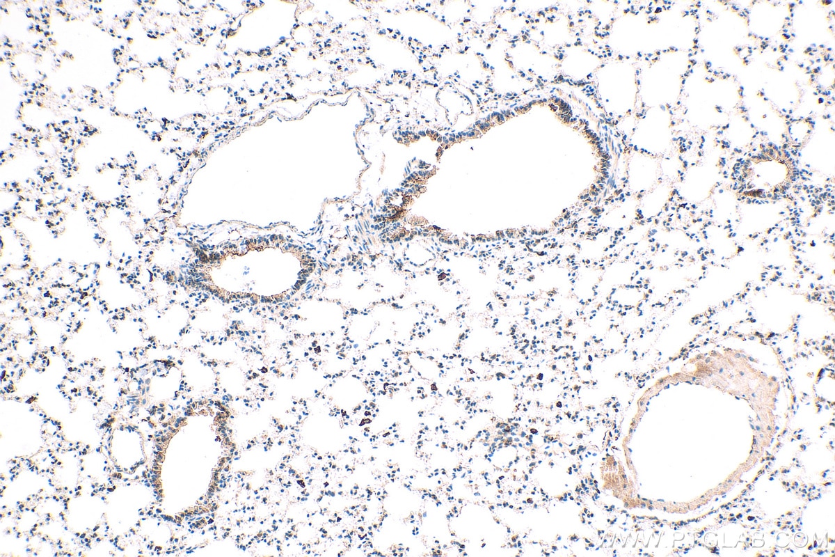 Immunohistochemistry (IHC) staining of mouse lung tissue using Cathepsin H Polyclonal antibody (10315-1-AP)