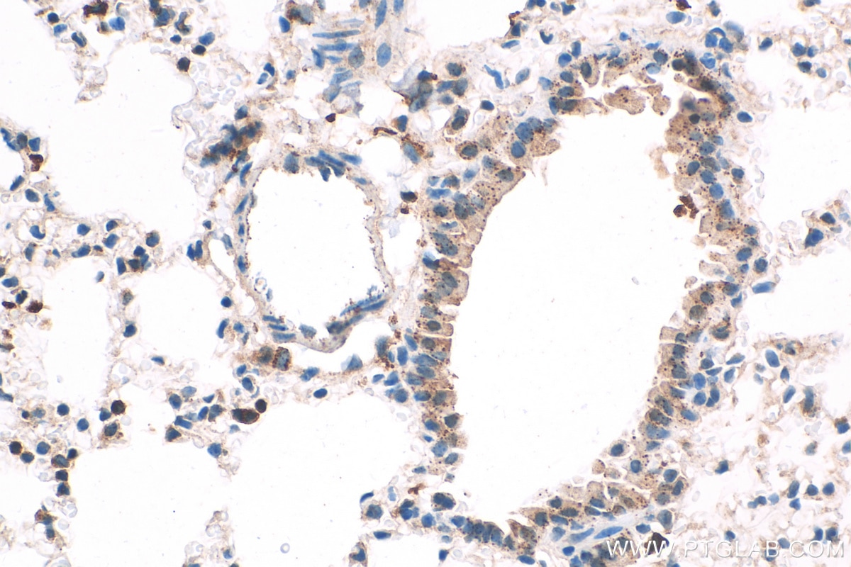 Immunohistochemistry (IHC) staining of mouse lung tissue using Cathepsin H Polyclonal antibody (10315-1-AP)