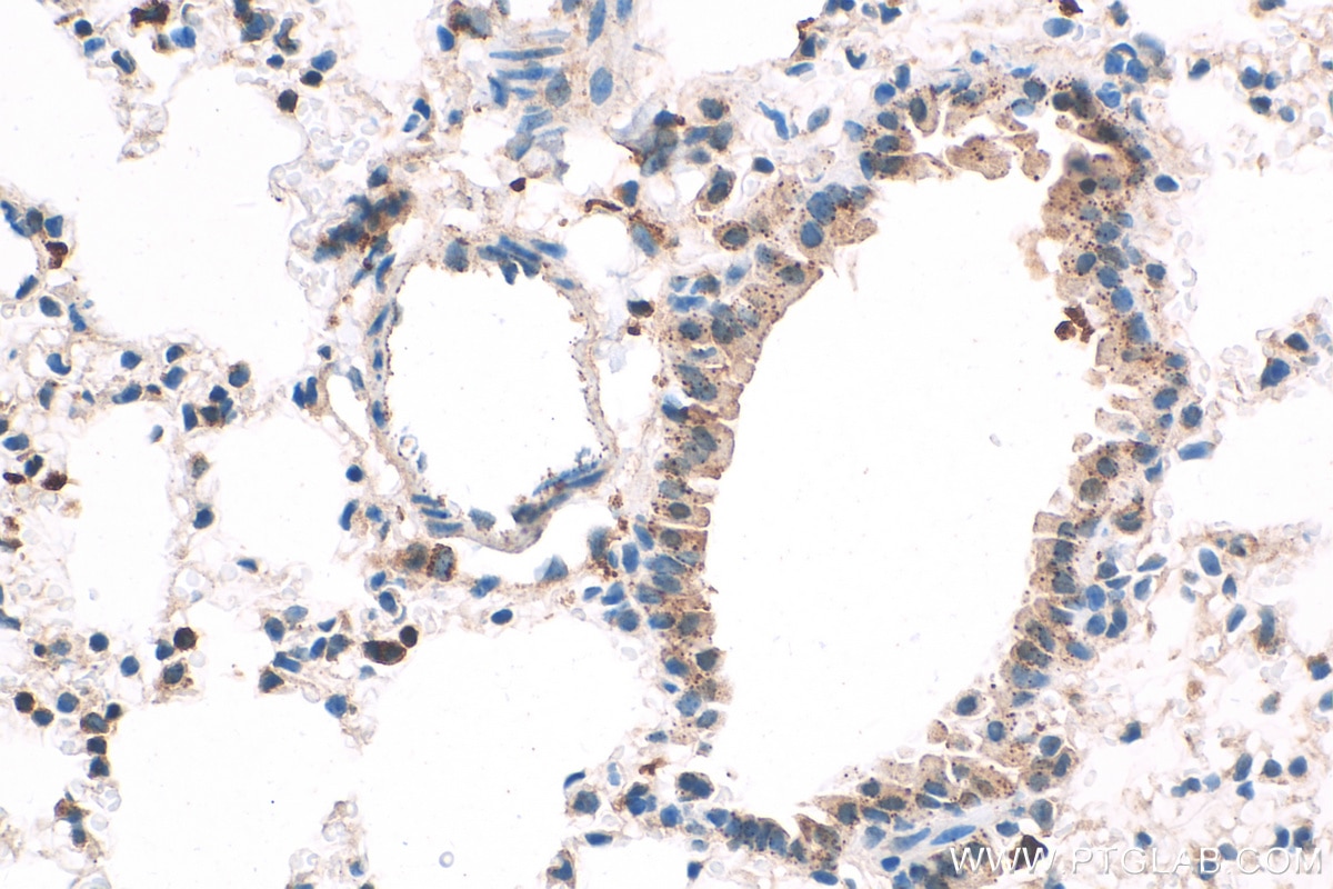 IHC staining of mouse lung using 10315-1-AP