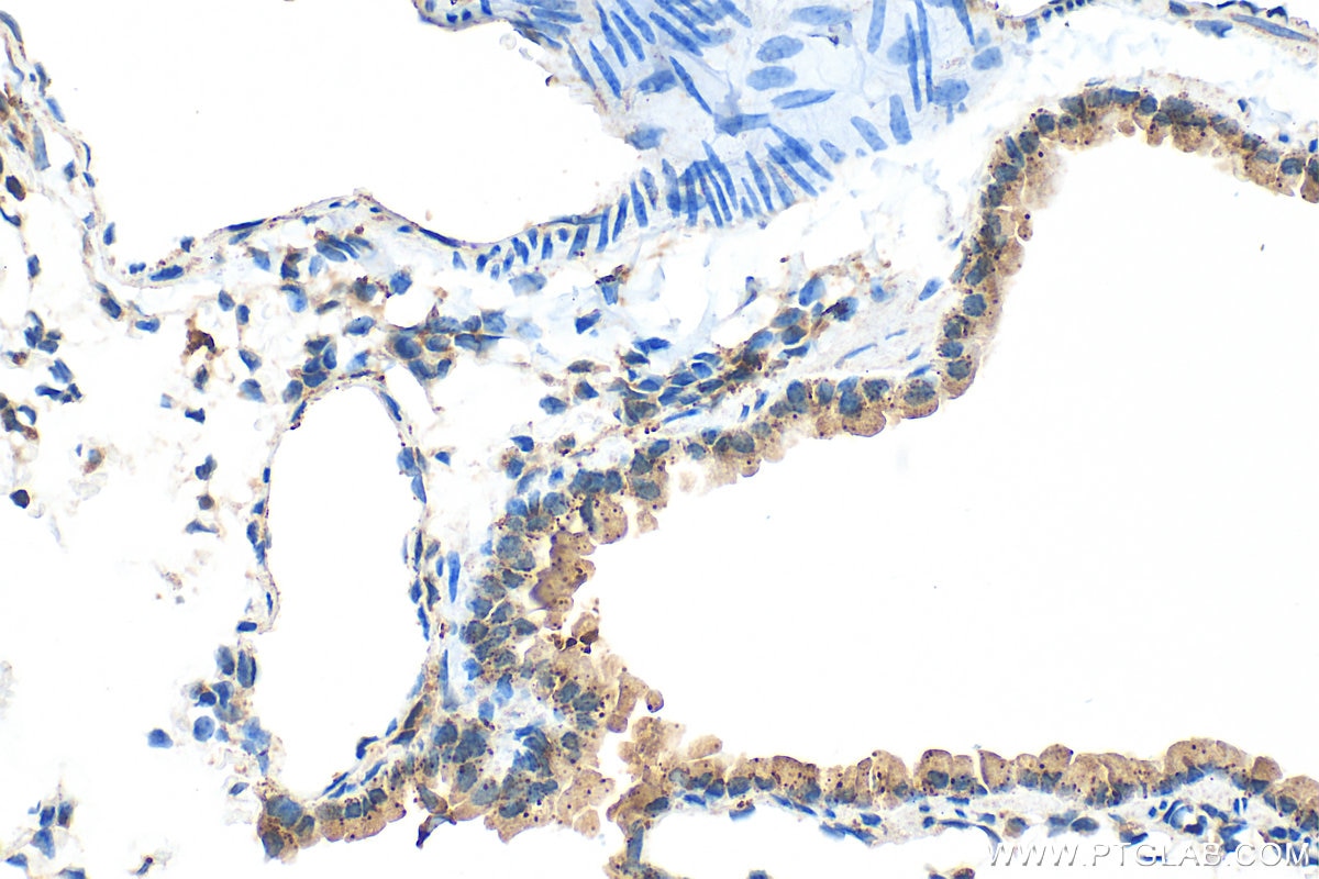 Immunohistochemistry (IHC) staining of mouse lung tissue using Cathepsin H Polyclonal antibody (10315-1-AP)
