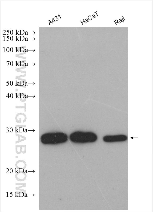 Western Blot (WB) analysis of various lysates using Cathepsin H Polyclonal antibody (10315-1-AP)