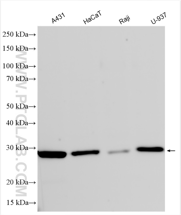 Western Blot (WB) analysis of various lysates using Cathepsin H Polyclonal antibody (10315-1-AP)
