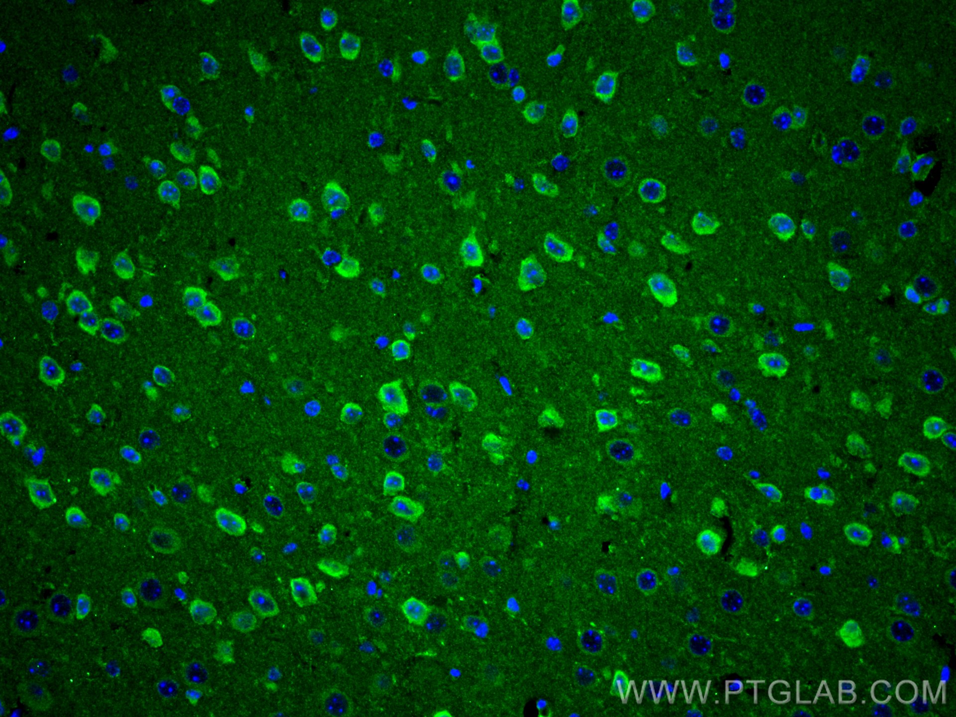 Immunofluorescence (IF) / fluorescent staining of mouse brain tissue using Cathepsin K Polyclonal antibody (11239-1-AP)